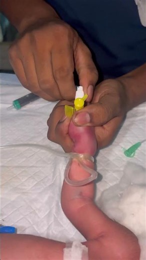 Newborn baby being kitkat🥲💉👍 #youtubeshorts #nursing #newbornbaby #injection #canula #sabscribe
