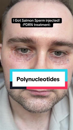 Brighten Your Skin with Salmon Sperm Facial Treatment