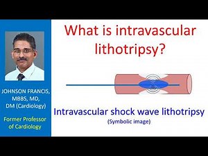 What is intravascular lithotripsy?