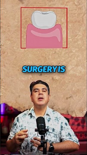 crown lenghtening procedure