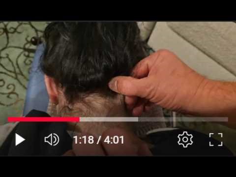 Suboccipital Release for Chronic Headaches & Migraines | Dr. Lorn Allison Demonstration