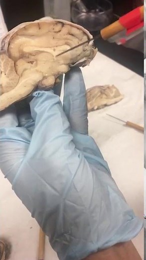 sheep brain anatomy, dr madden