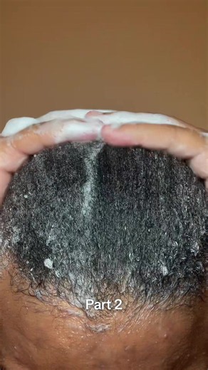 ‼️(1900/5000)‼️ #hygiene #hairgrowth #4chair #curlyhair #mensgrooming | 4c hair men