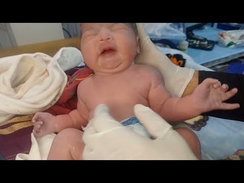 Newborn of Diabetic Mother in Distress 😱 | Weak Cry Management
