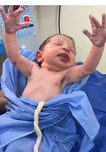 ‏#baby Moro reflex | baby