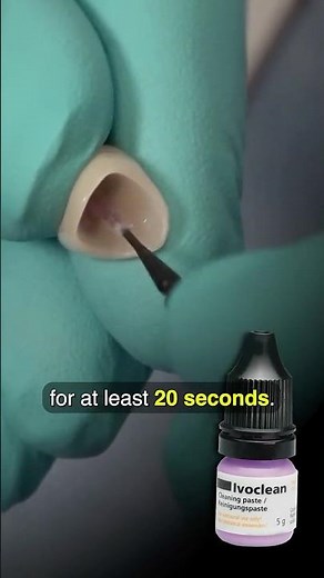 HOW TO Deliver Zirconia Crowns for the ANTERIOR Teeth #dentist