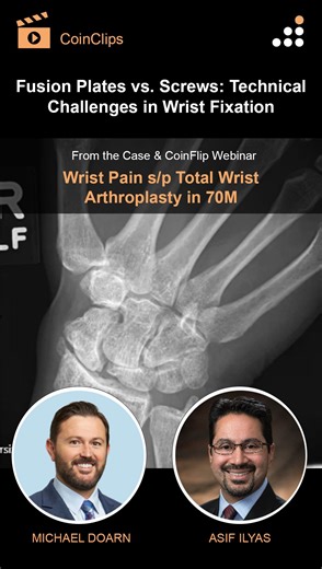 Here is a clip from our latest episode of CoinFlips & Controversies, “Wrist Pain s/p Total Wrist Arthroplasty in 70M” featuring expert faculty from the 10th Annual Frontiers in Upper Extremity Surgery Course (taking place November 14-15, 2025 at FIVE Labs in Tampa, Florida.) Watch Drs. Doarn & Ilyas, discuss “Fusion Plates vs. Screws: Technical Challenges in Wrist Fixation”. Click here to learn more about the 2025 Frontiers Course and watch their full webinar on Orthobullets: https://orthobullet