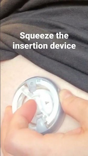 Insulin Pump Infusion Set Insertion (AutoSoft 90)