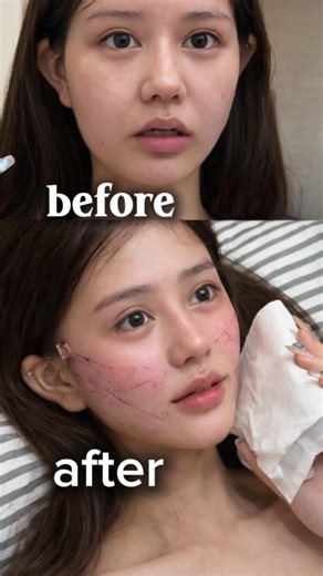 Real face surgery transformation ✨ Professional surgical treatment with real results#shorts#beauty