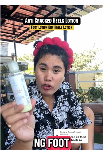 Effective Foot Lotion for Anti-Cracked Heels