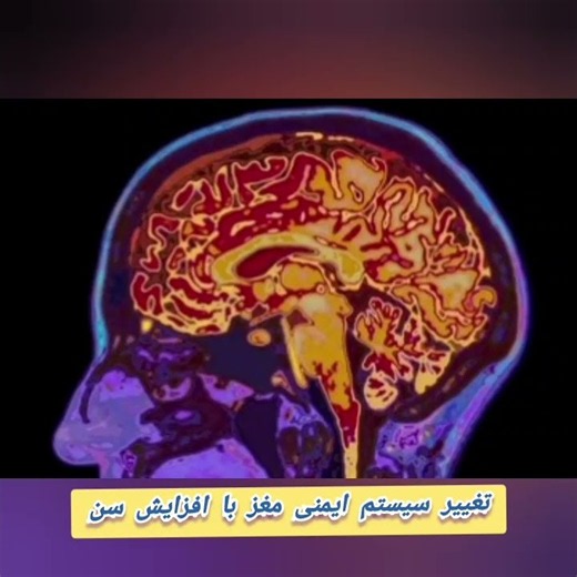 افزایش سن فقط باعث تخریب مغز نمی‌شود. سیستم ایمنی مغز را تغییر می‌دهد
