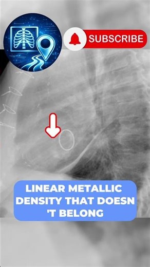 Would You Catch This After Surgery? #radiology