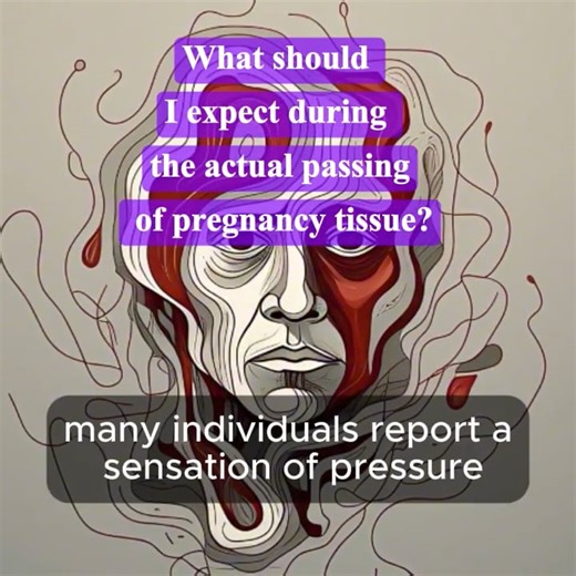 5- FAQ7: Misoprostol: What to Expect When Passing Pregnancy Tissue