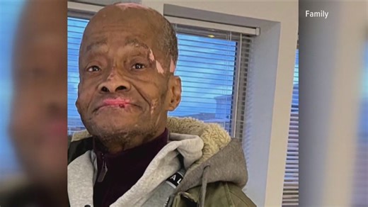 DC Deputy Chief Medical Examiner testifies in trial of girls accused of beating man to death