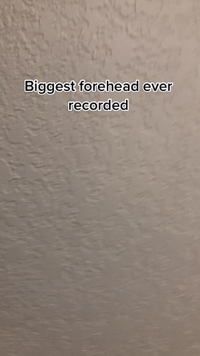 Biggest Forehead Ever Recorded: A Unique Find
