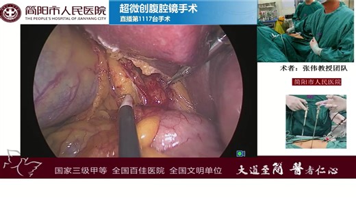 直播第1118台超微创隐疤痕无剪辑版14分钟（仅供医学专业观看）