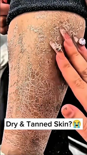 Remove Dry & Cracked Skin At Home | Dry Tanned Skin Removal Scrub #skinwhitening #dryskincare #diy