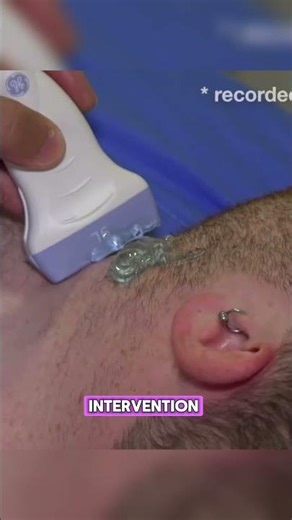 Prevention starts with Vascular Screening