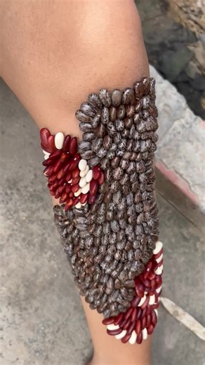 Understanding Ticks and Their Impact on Outdoor Living