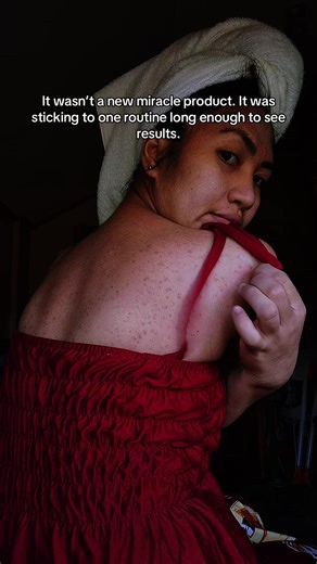 The Secret to Managing Bacne Effectively