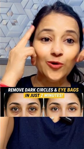 2 Minute Eye Bag Removal Trick 😱 | Dark Circles Home Remedy | Instant Glow Hack #shorts