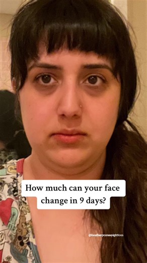 With a PCOS routine, my face finally looks like mine again 🩷 A PCOS routine includes PCOS meals, movements, supplements, and other habits that align with YOUR individual needs because PCOS is HIGHLY complex. Luckily for you, I have all 4 PCOS types and share how I manage them here! Check out my profile for my support group and playlists where everything is organized easily for you. #pcos #pcosawareness #pcosweightloss #beforeandafter #transformation