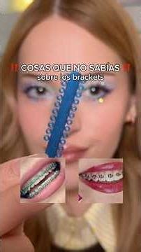 NECESITAS saber esto de los brackets 😱‼️ #maquillaje #brackets #ortodoncia #dientes #braces