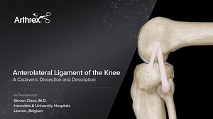 Anterolateral Ligament Dissection