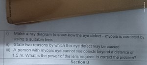 i) Make a ray diagram to show how the eye defect - myopia is co... | Filo