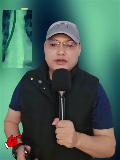 अचम्मित घ ट ना बुटवलमा #titoknepal #for #fouryoupage #ramlimbu12 Nepal