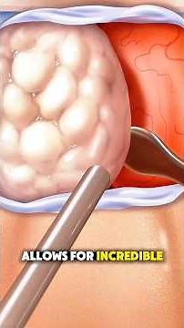 How Endoscopic Pituitary Surgery Is Done 🧠 | 3D Medical Animation Explained! #Shorts