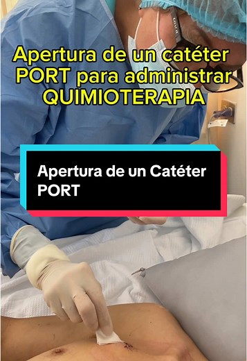 Apertura de un Catéter PORT: Guía para Enfermería
