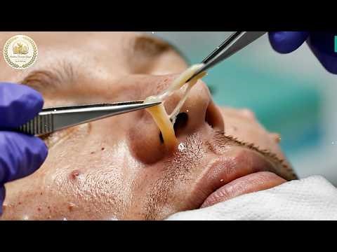 [ASMR] Dr. Lee’s full facial glow routine blackhead care for natural radiance dreams unravel 968