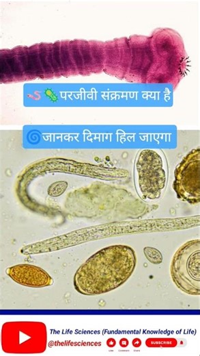 🪱🦪🦠What is Parasite Infection 🪱🪱 parjivi sankraman kya hota hai #parasite #infectiousdisease #shorts