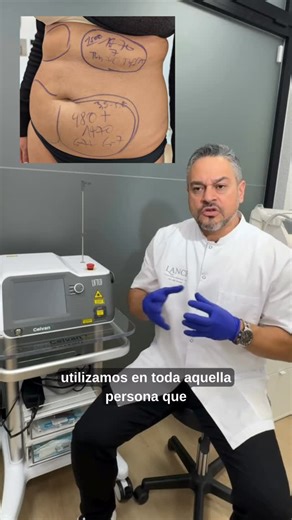 Clínica LANCE Medicina Estética, Regenerativa e Íntima on Instagram: "Tensar, redefinir i eliminar greix sense cirurgia amb ENDOLÀSER🔦 L’endolàser actua des de dins per tensar la pell i activar la lipòlisi, eliminant el greix acumulat i redefinint el contorn corporal i facial. Resultats visibles, precisió mèdica. 👉🏻Papada, braços, cuixes, cartutxeres, abdomen, glutis, cel·lulitis, lifting facial… 💌 Agenda la teva cita per valorar el teu cas —- Tensar, redefinir y eliminar grasa sin cirugía c