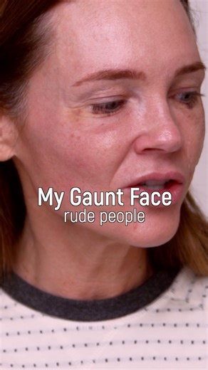 My gaunt face brings out the trolls 👿 and I get it…kind of…I understand that I share self improvement but I’m also real about it. I never show up with makeup (that’s rare) I don’t have filler in my face and I have not had any work done on my face. I’ve also been doing this for a long time and that means over time I will shape shift. Over the last two years I’ve been having many personal challenges that have affected my weight and my face, believe it or not this is my real life and instead of st