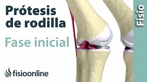 Ejercicios para la Rehabilitación de una Prótesis de Rodilla - Primera Fase