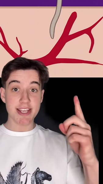 How the body reacts to a mosquito bite in detail