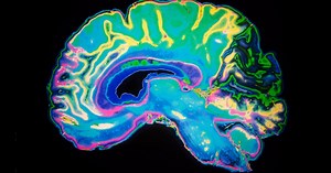 Inside the brains of psychopaths