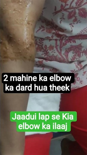 pahle visit mein kiya jaadui lap se elbow ka ilaaj