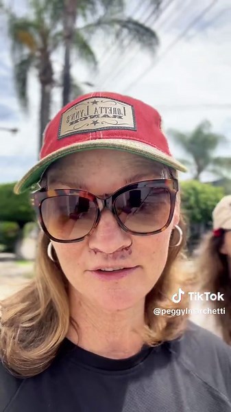 Identical Twin's Blepharoplasty and Lip Lift Journey