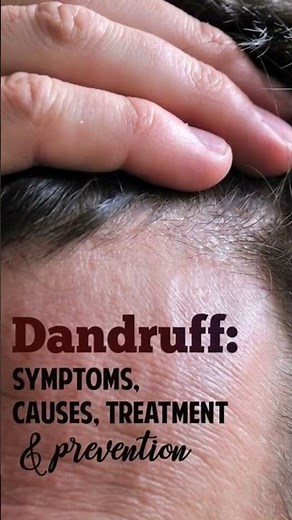 ❄️ Dandruff: Symptoms, Causes & Treatment 🧴Symptoms:✔️