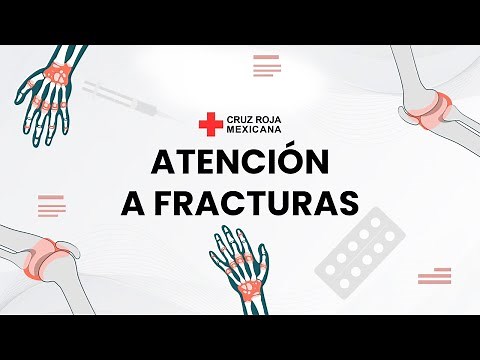 ¿Qué hacer en caso de una #fractura? #PrimerosAuxilios