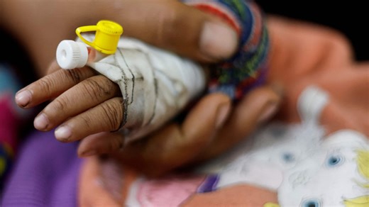 Inside a Gaza hospital where doctors struggle to treat malnourished, dehydrated children