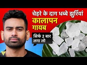 वरदान है ये पत्थर | 10 Amazing Benefits of Alum/Fitkari