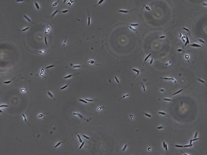 Polysome Profiling in mRNA Analysis | JoVE Journal