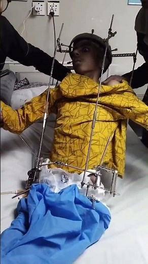 Halo pelvic traction