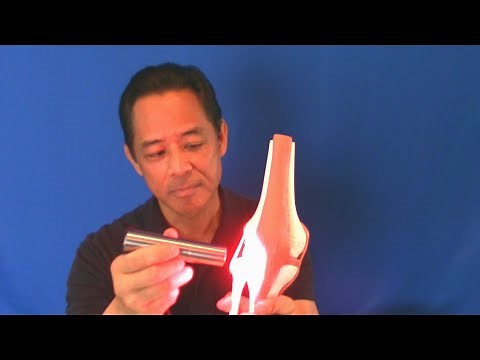 Stop Knee Pain from Osteoarthritis By Doing THIS