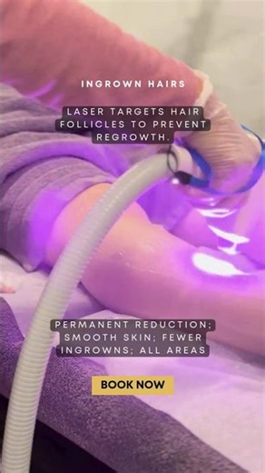 Smooth Skin, Zero Hassle Laser Hair Removal That Fits Your Life #shorts