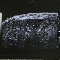 Video: Fetal Mouse Cardiovascular Imaging Using a High-frequency Ultrasound 30/45MHZ System